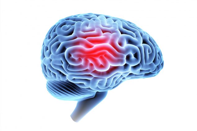 Who Can File a Lawsuit for a Brain Injury?